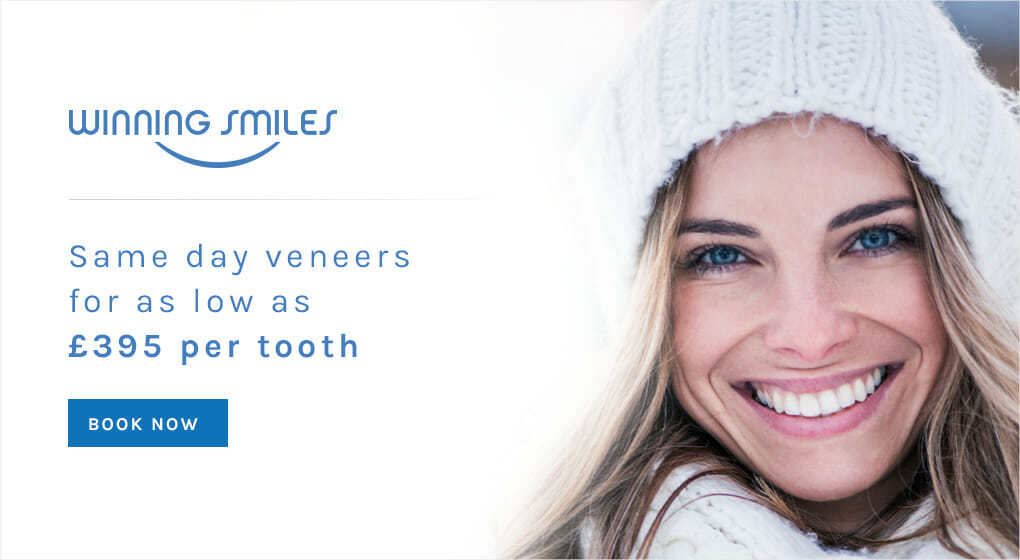 v4_instant_veneer_banner