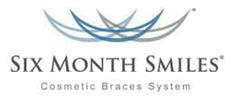 Six Month Smiles | Cosmetic Braces System in Romford, Essex | Winning Smiles