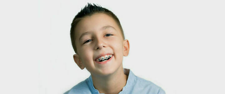 Children Orthodontics in Romford, Essex | Winning Smiles Dental Clinic