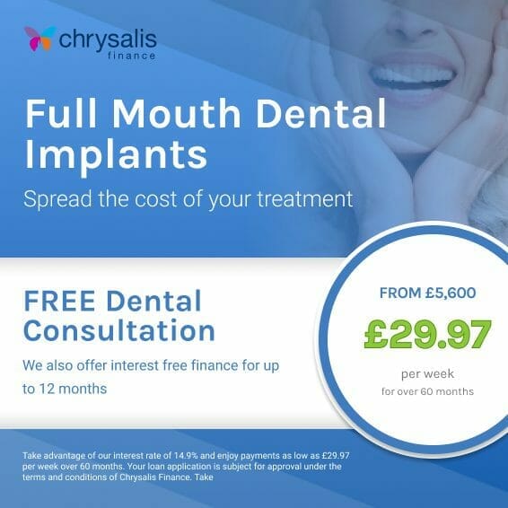 Full Mouth Dental Implants Pricing