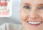 Full Arch Replacement in Romford, Essex | Dental Implants Services | Winning Smiles Dental Clinic